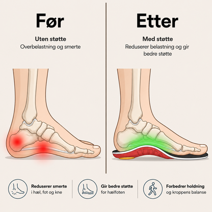 NoNeedyKnee FlexStep™ – Ortopediske støttesåler for bedre komfort hele dagen